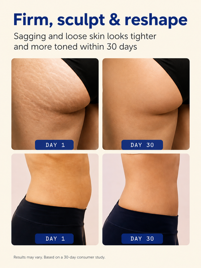 Firming Gold Gel | Warming Body Gel for Thighs, Belly & Arms