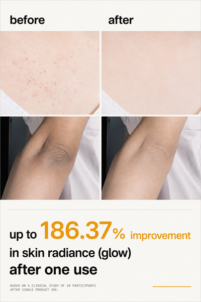Exfoliating Kojic Acid & Turmeric Spray
