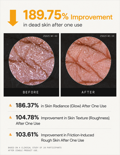 Exfoliating Kojic Acid & Turmeric Spray